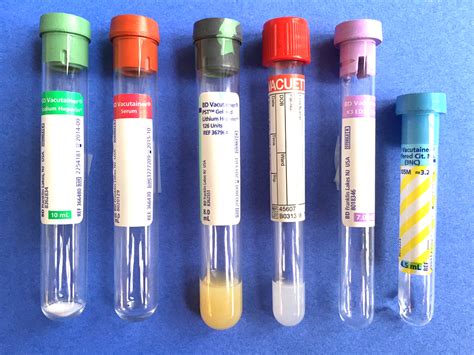 calcium blood test bottle colour|blood bottle toxicology test.